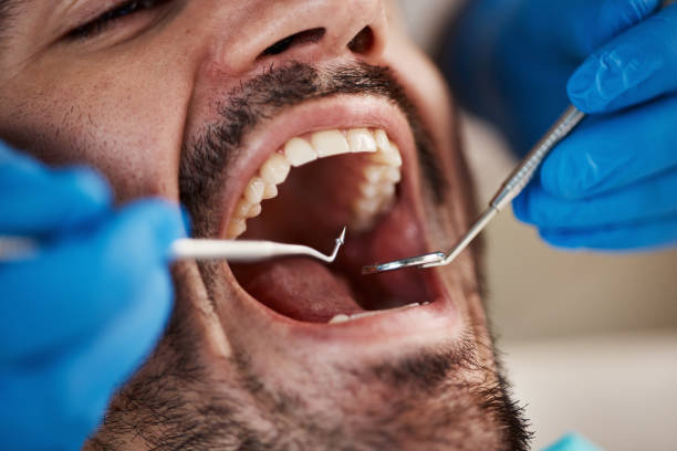 Best Emergency Tooth Extraction in Glen Head, NY